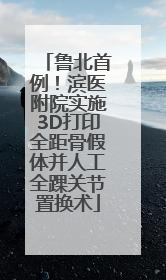 鲁北首例！滨医附院实施3D打印全距骨假体并人工全踝关节置换术